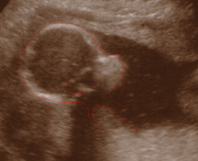 labolina_v19+0_2.jpg